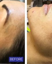 dermani MEDSPA Granger image 19