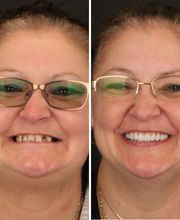 Britely Dentures + Implants Studio image 10