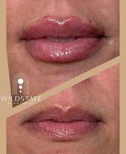 WildState Lawton image 12