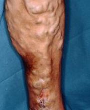 Consulta Barreiro-Vascular (Drs. A. Barreiro Mouro y J. Barreiro Veiguela) imagen 4