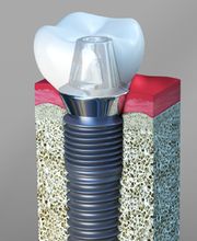 Smile Select Dental Alta Loma image 5