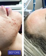 dermani MEDSPA Granger image 8