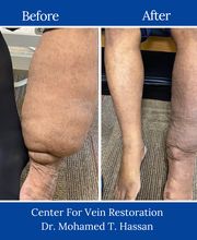 Center for Vein Restoration | Dr. Mohamed Hassan image 5