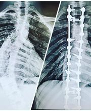 Centers for Neurosurgery, Spine, & Orthopedics image 5