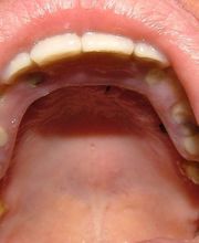 Clínica Implanteoral Milladoiro imagen 7