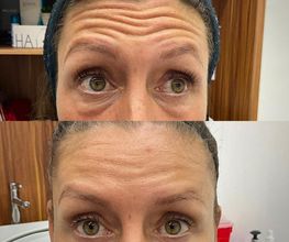 Juvenalia Brío | Botox, Hydrafacial & Ultraformer - Condesa / Roma Norte CDMX imagen 9