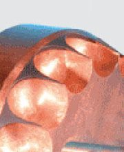 Meyer Eberhard GmbH Bild 4