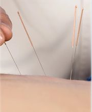 TCM Praxis Eveline Petro Bild 4