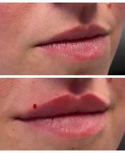 Blush Med Spa image 18