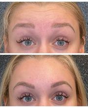 Truly Lifted MedSpa image 9