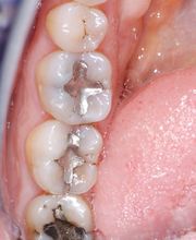 Bodensee Implantatzentrum Dr. Wolfgang Prinz MDSc Zahnarzt/ Implantologie Bild 8