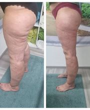 Therapie Serra Massage Bild 4