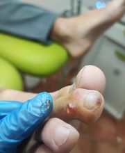 Podología clínica y deportiva Sureste imagen 6