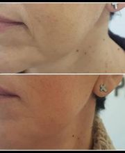 CENTRO ESTÉTICO ESTHER CABALLERO imagen 12