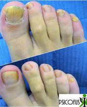 Centro Clínico PSICOFUSION imagen 13