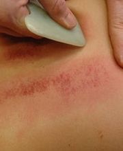 TCM Zhen GmbH Bild 3