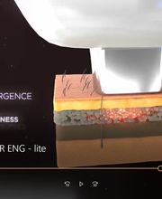 MEDILASE Lasers Médicaux et Photonique Médicale image 5