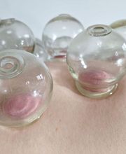 Akupunktur, traditionelle chinesische Medizin und Naturheilverfahren - TCM Praxis Dr. Miersch Bild 3