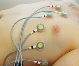 EKG