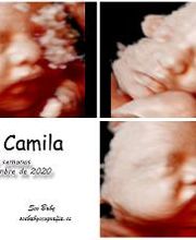 See Baby Ecografía Emocional imagen 17