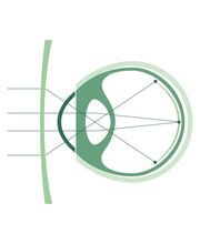 Ottica Martini Sagl Bild 2