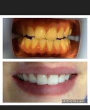 Dinastétique esthéticienne visagiste dermographe image 8