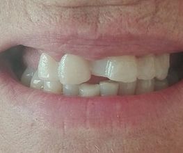 Clínica Dental Quart imagen 16
