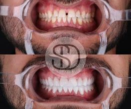 Supreme Dental Clinic imagen 18