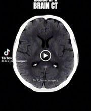 Psiquiatra BH - Dr Márcio Candiani - TDAH e Autismo imagen 1