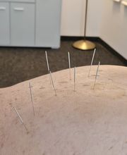 Oase TCM | Akupunktur, Chinesische Medizin für Baselland und Basel Bild 4