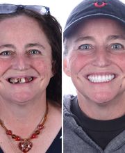 Britely Dentures + Implants Studio image 2