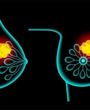 Karine Leroux image 20