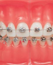 Dr. Baumann Kieferorthopädie AG Zahnspange St. Gallen Bild 5