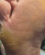 PodoAkitve Berlin Bild 7