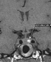 Prof. Dr. med. Merlo Adrian Bild 6