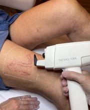 CALLICROMIA LASER STUDIO di Pagliuca Michela Bild 6