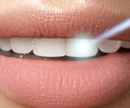 Il Dentista Dr. Alessandro Rossi SA Bild 6