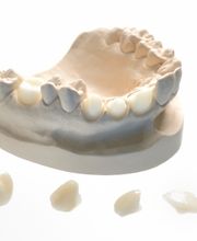 Hasenböhler Zahntechnik AG Bild 2