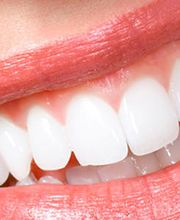 Dr. med. dent. Meichtry Marco Bild 1