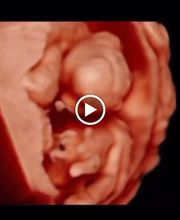 Ecox Dos Hermanas, Sevilla  Especialistas en ecografías 5D, 4D y 8K imagen 11