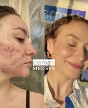 dermani MEDSPA Houston | Valley Ranch image 13