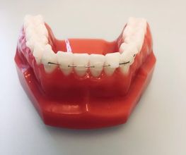 ORTHOLIGHT Orthodontie Bild 5