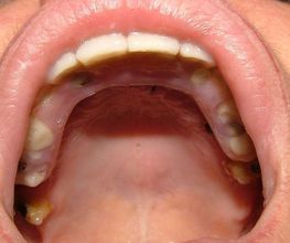 Clínica Implanteoral Milladoiro imagen 7
