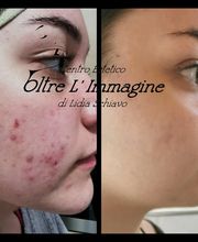 Centro Estetico Oltre L'Immagine di Lidia Schiavo Bild 5