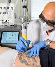 Tattooentfernung neueste Technologie