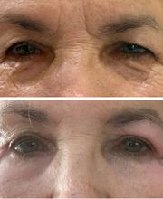 Wrinkle Free WA image 12