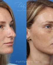 Gotham Plastic Surgery image 14