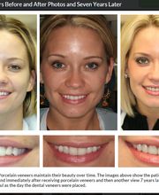 The Dental Design Center - Cosmetic, Implant & General Dentistry image 16