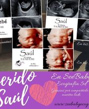See Baby Ecografía Emocional imagen 4