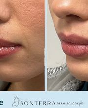 Sonterra Dermatology image 10